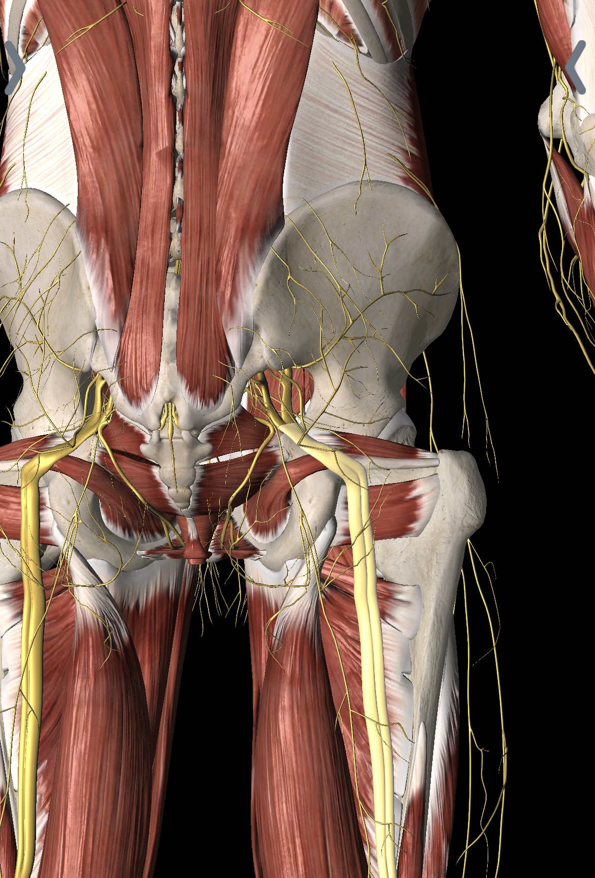 Sciatica explained